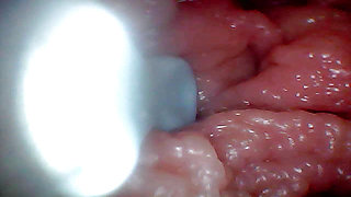 First time: An endoscope reveals the G-spot up close - without mountingl
