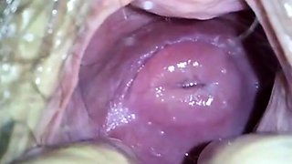my japanese girlfend's cute cervix in huge hole