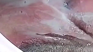 Selection of Vacuum Masturbation of the Vagina