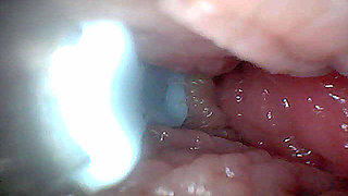Visual Guide to G-Spot Stimulation and Orgasm - Endoscopic Perspective