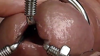 Dilation of the Hole Expanded Glans and Sperm Blockage Through Urethral Insertion of the Finger - Closeup