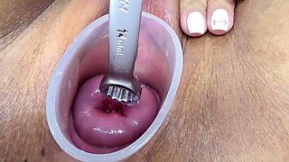 Japanese Wife Open Cervix Wide to watch inside Uterus