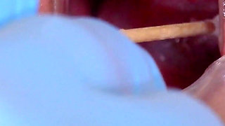 Silicone Sex Bomb Gets Treatment for Her Irritated Cervix