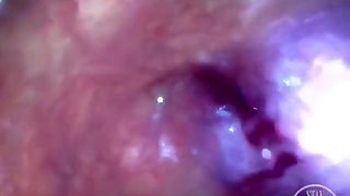 POV Extreme Deep Anal Exploration! Fast Visible Heartbeat