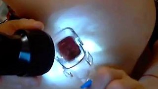 Russian Webcam Girl Uses Anal Speculum for Gaping Show