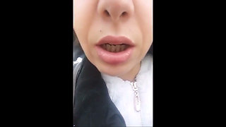 My Step Mom Is Insane! She Burps Everywhere and All the People Can Hear!