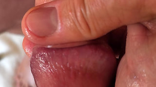 Foreskin back