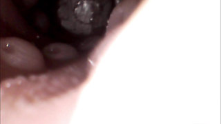 Endoscope Lens Captures Unbearable Pleasure