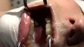 Spit and More Spit! Let Me Just Cover You!