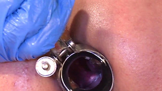 Anatomy Part 2 Anal Speculum, the Depth Measurement, the Sample, the Insemination and Much More