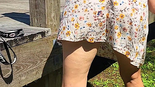 Park Minidress Tease