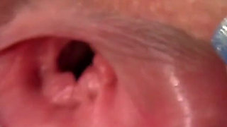 I hunt my cunt - nurse Lucie looks into her pussy with speculum in gynecological surgery