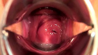 Amateur Asian anal creampie on real homemade video